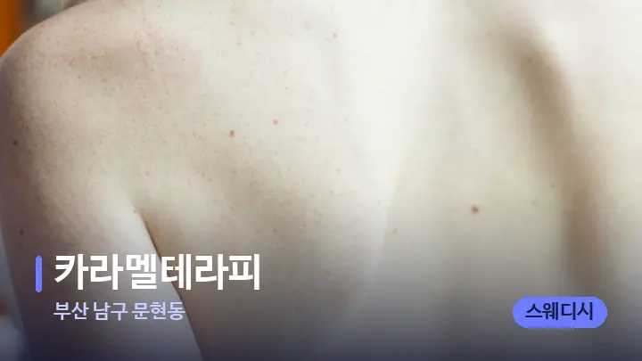 부산 남구 문현동 카라멜테라피 — 등·허리 오일 관리 장면